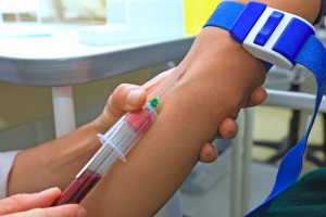 Анализ крови на ВПЧ