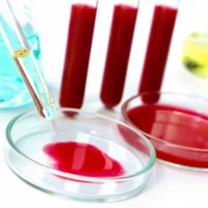 Как сдать анализ крови на креатинин и правильно расшифровать результаты?