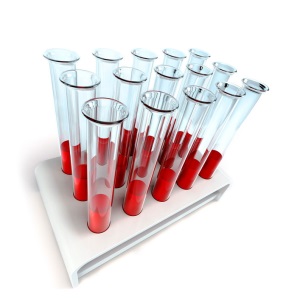 Как и для чего необходимо сдавать анализ крови на токсоплазмоз